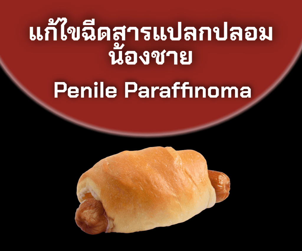 เลาะสารเหลวน้องชาย